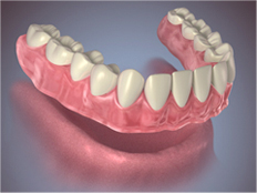 A full denture | Same-Day Dentures | Aegis Dental Group or Angola Dental Center