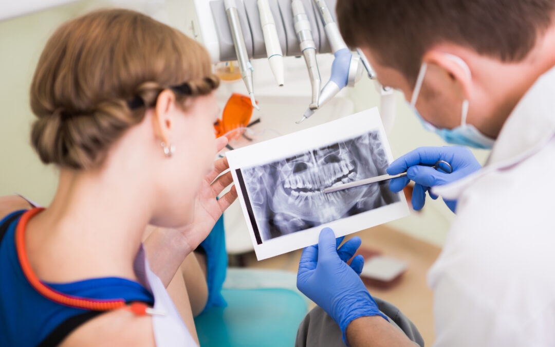 4 Warning Signs You Probably Need Dental Implants