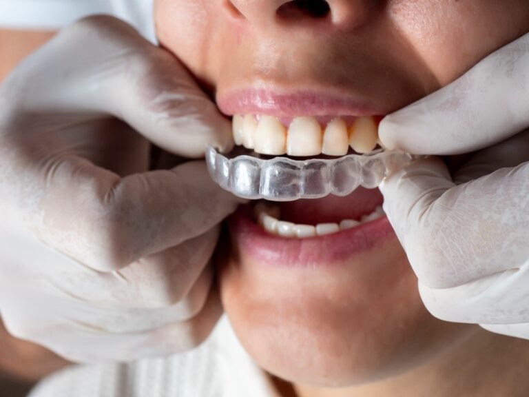Retainers vs Braces What You Need To Know Aegis Dental Group