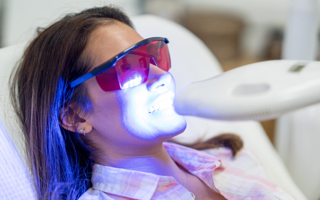 Teeth Whitening in Indiana