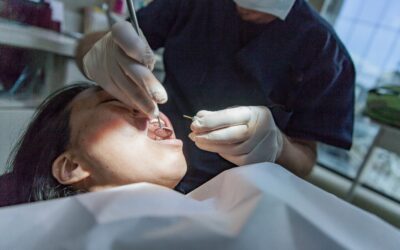 Simple vs. Surgical Tooth Extraction