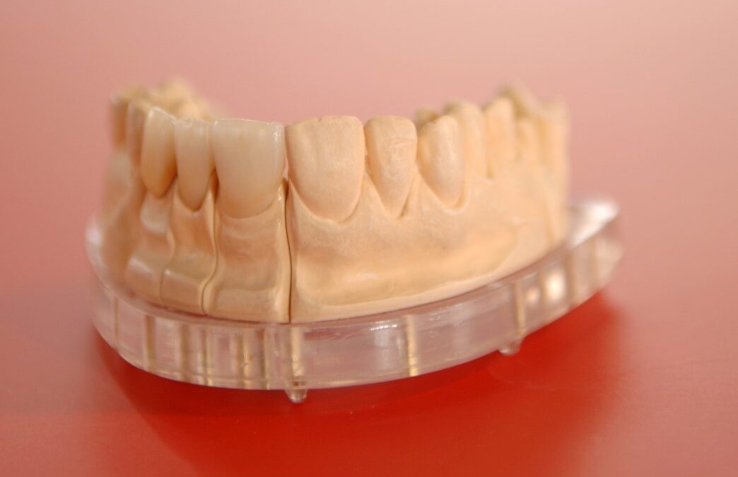 Signs You Need Denture Adjustment or Repair