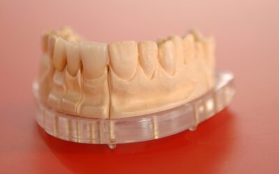 Signs You Need Denture Adjustment or Repair