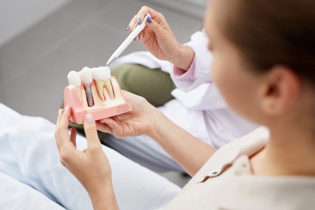 What You Need To Know About the Dental Implant Procedure