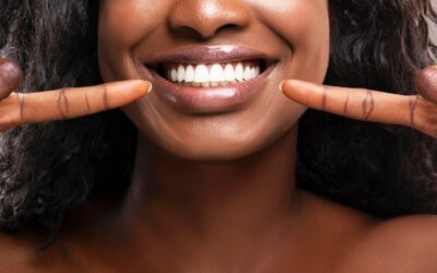 Why Professional Teeth Whitening Is Superior to DIY Solutions