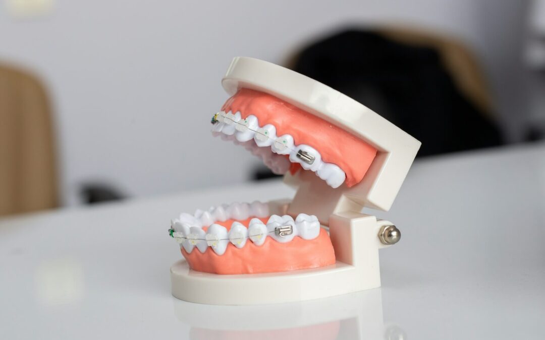 Clear Aligners vs. Traditional Braces: Pros and Cons