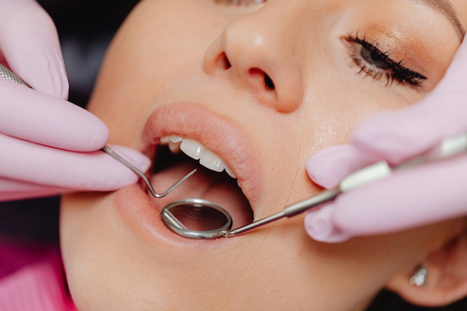 root canal treatment