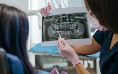 How Much Does Wisdom Teeth Removal Cost?