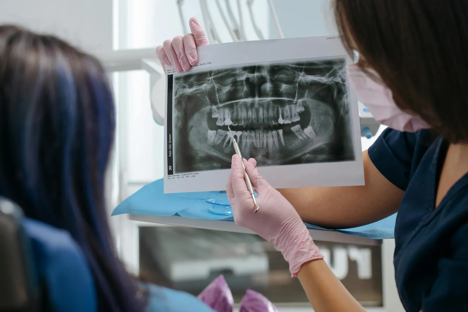 root canal treatment