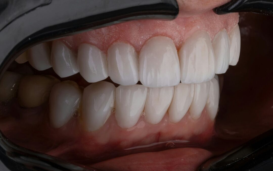 How to Stop Periodontitis: A Guide to Protecting Your Gums and Saving Your Smile