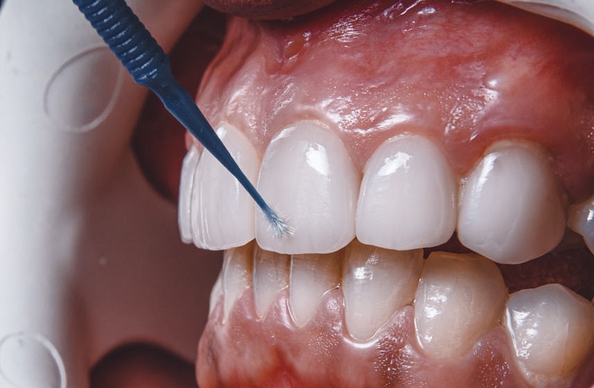 root canal treatment root canal treatment