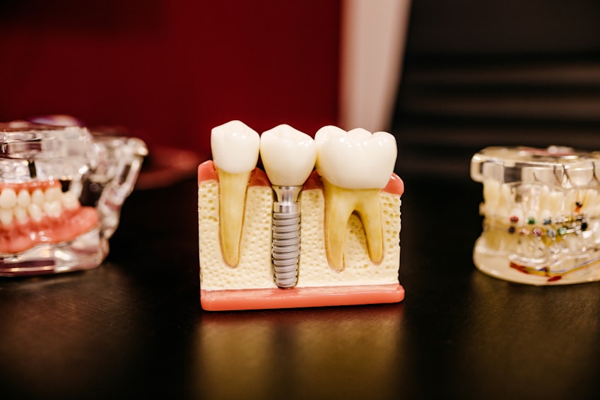 root canal treatment root canal treatment