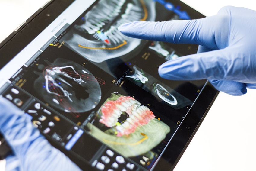 root canal treatment root canal treatment