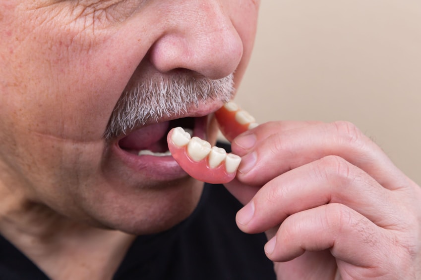 root canal treatment root canal treatment