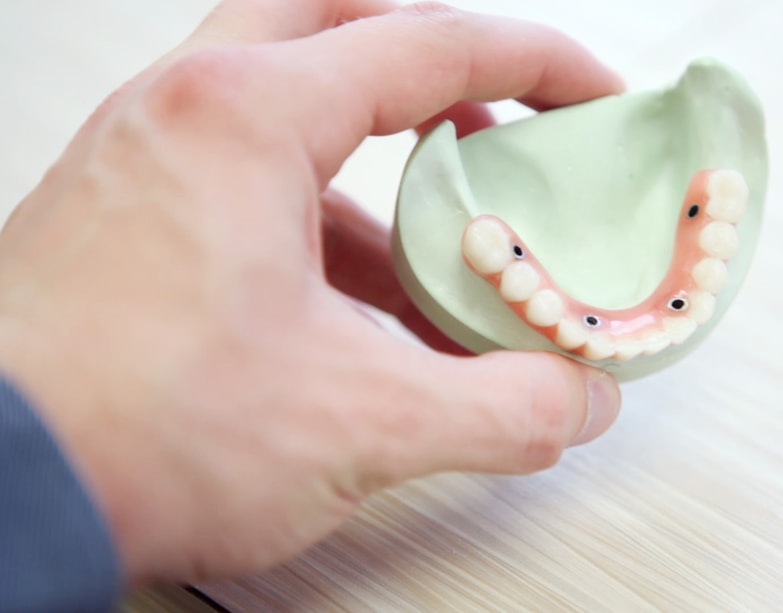 root canal treatment root canal treatment