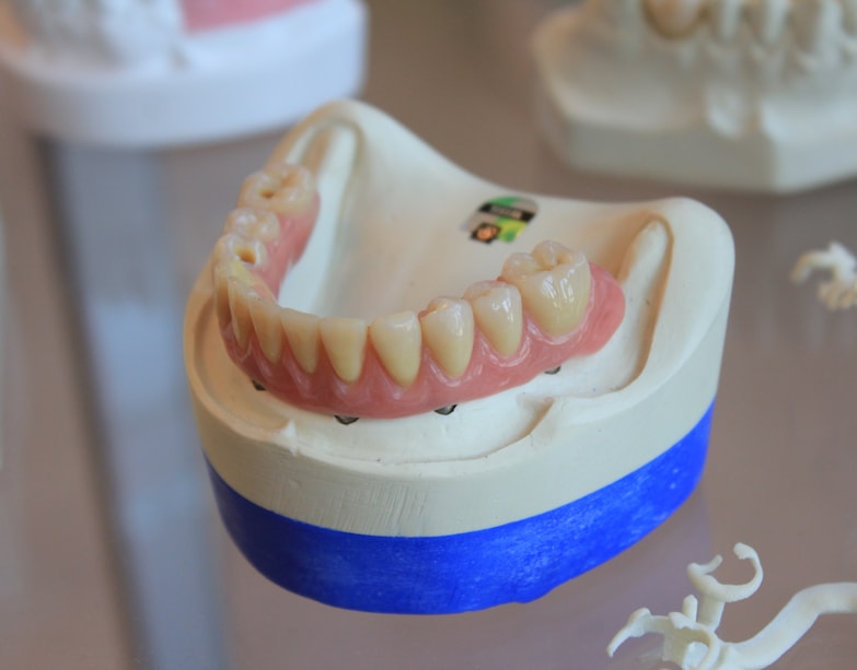 root canal treatment root canal treatment