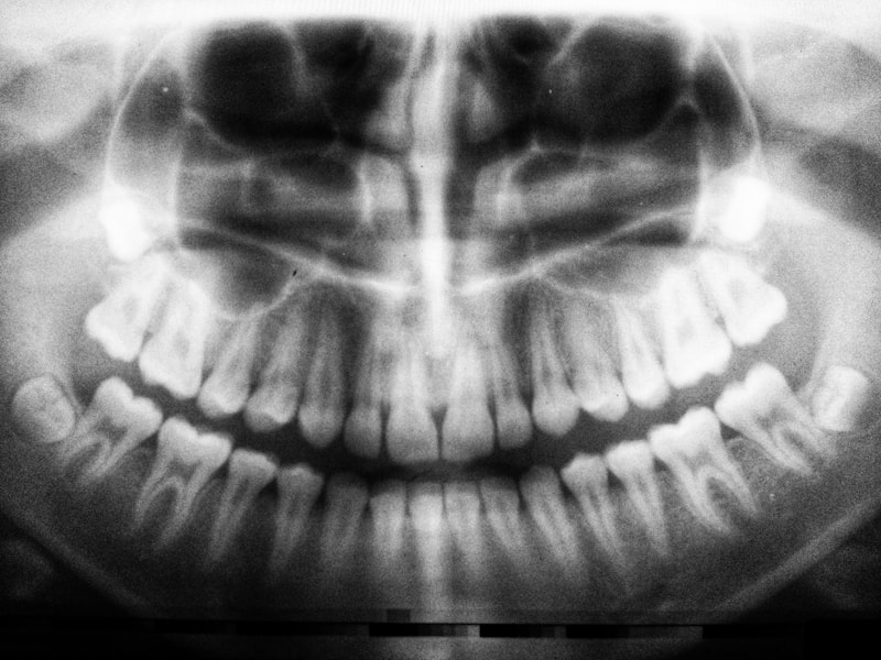 root canal treatment root canal treatment