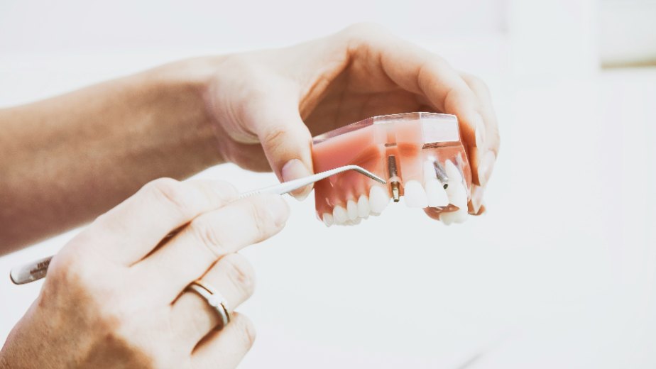 root canal treatment root canal treatment