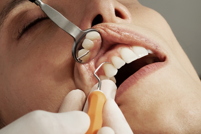 root canal treatment root canal treatment